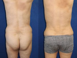 Before and After Image