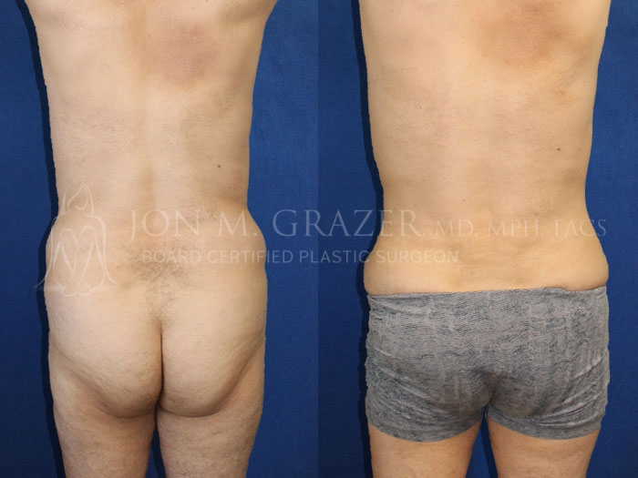 Before and After Image