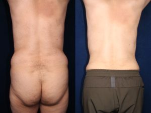 Before and After Image