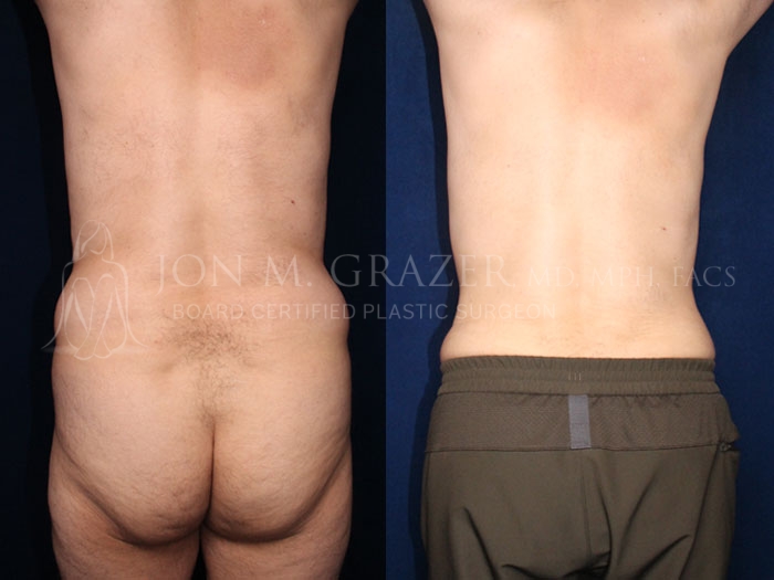 Before and After Image