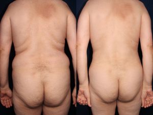 Before and After Image