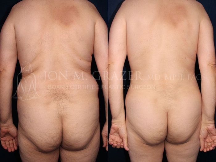 Before and After Image