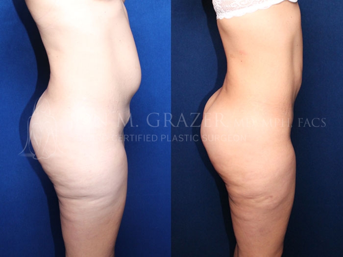 Before and After Image