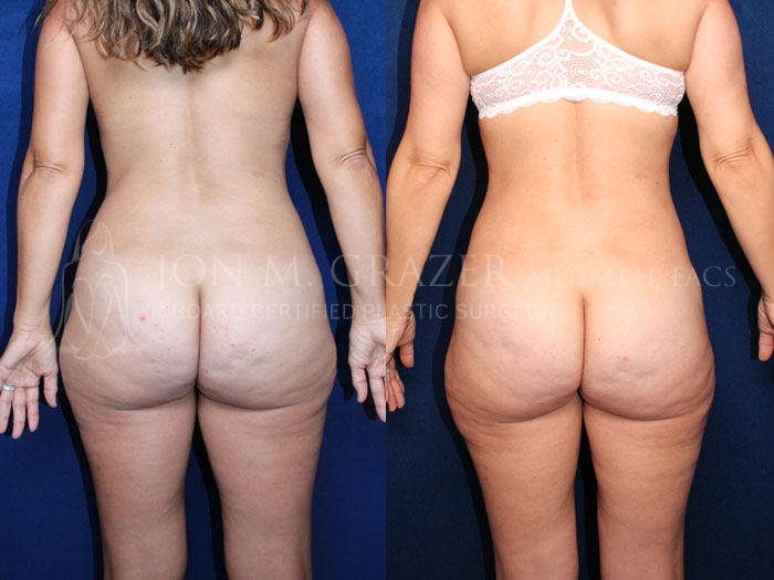 Before and After Image