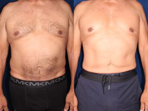 Before and After Image