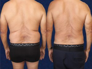 Before and After Image