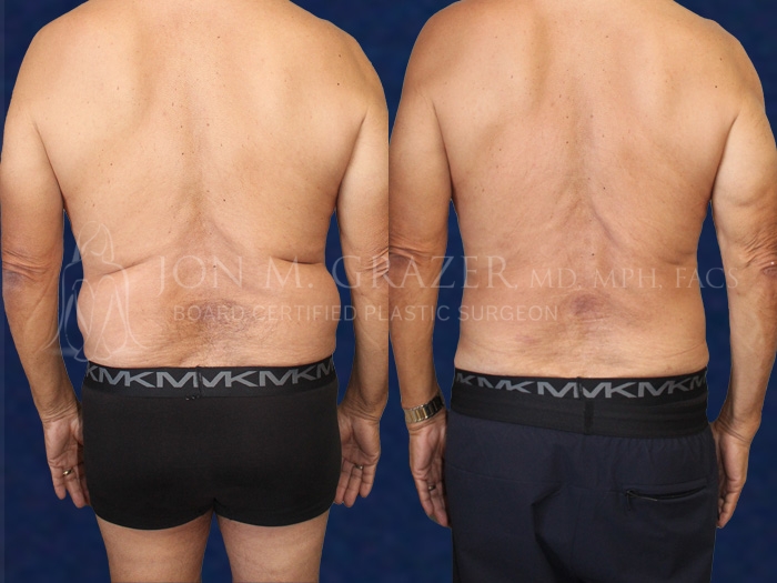 Before and After Image