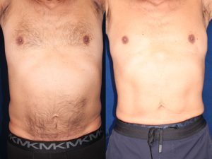 Before and After Image