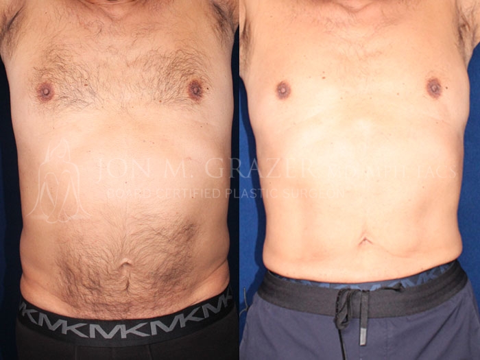 Before and After Image