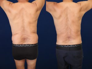 Before and After Image