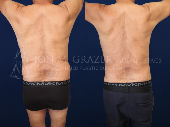 Before and After Image