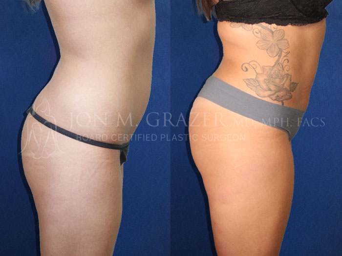 Before and After Image