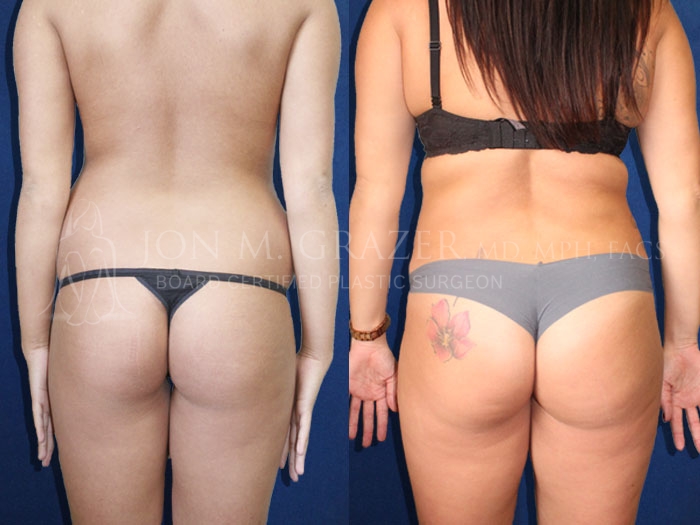 Before and After Image