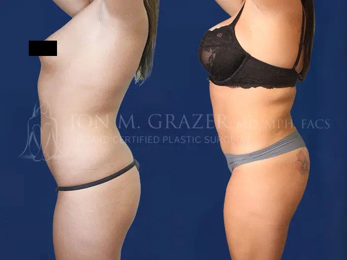 Before and After Image