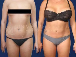 Before and After Image