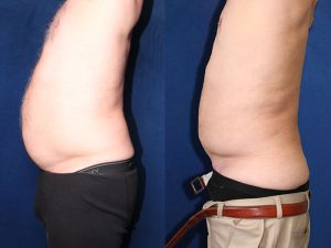 Before and After Image