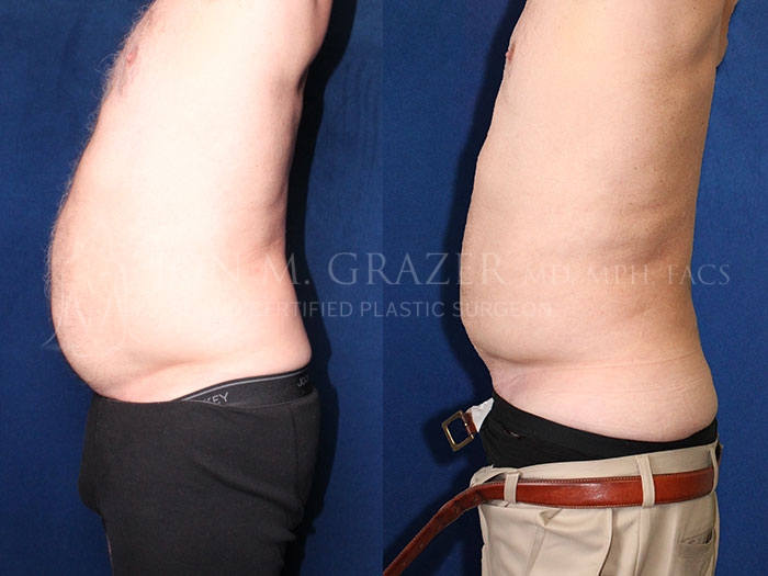 Before and After Image