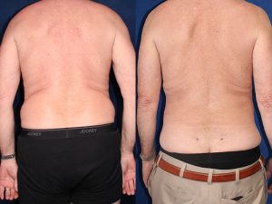 Before and After Image