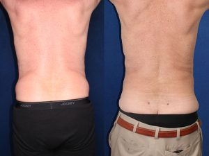 Before and After Image