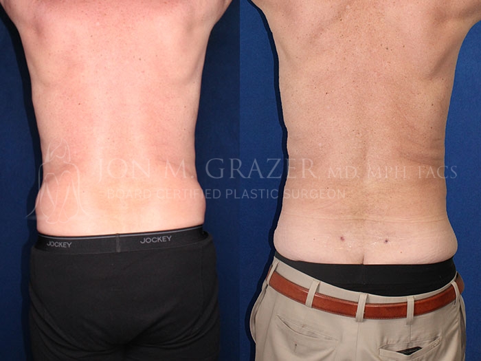 Before and After Image