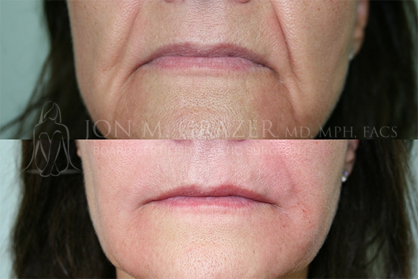 Before and After Image