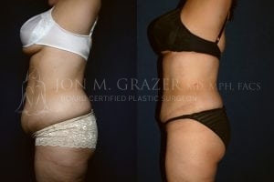 Before and After Image