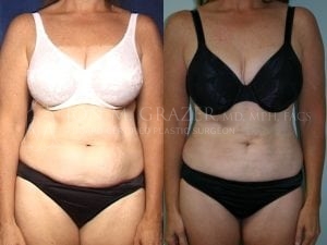 Before and After Image