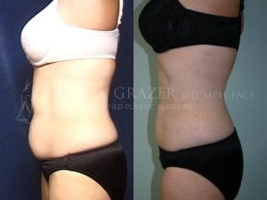 Before and After Image