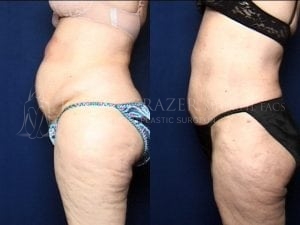 Before and After Image