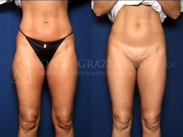 Before and After Image