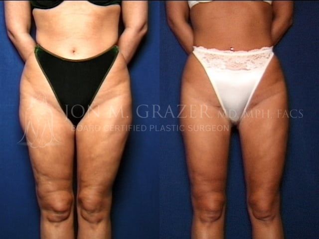 Before and After Image