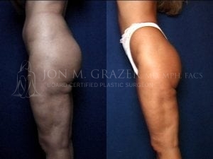 Before and After Image