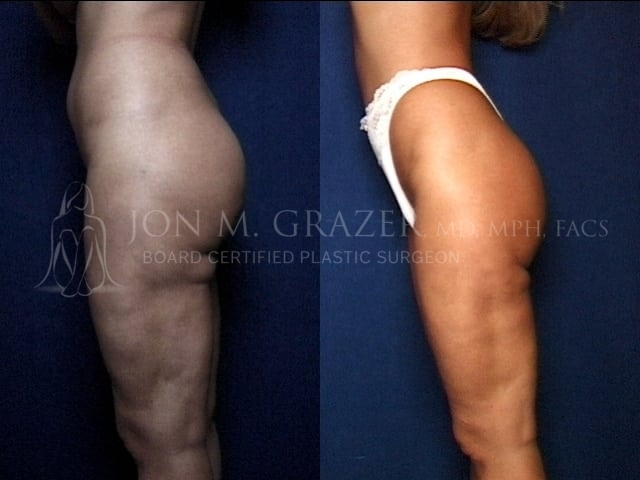 Before and After Image