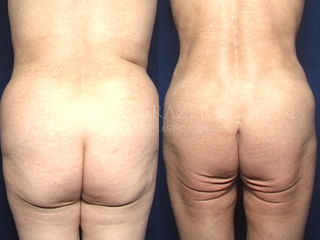 Before and After Image