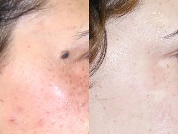 Before and After Image