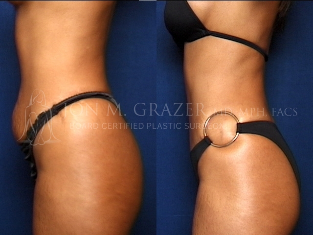 Before and After Image