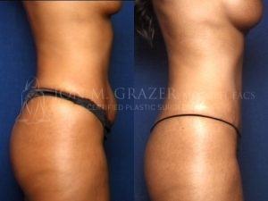 Before and After Image