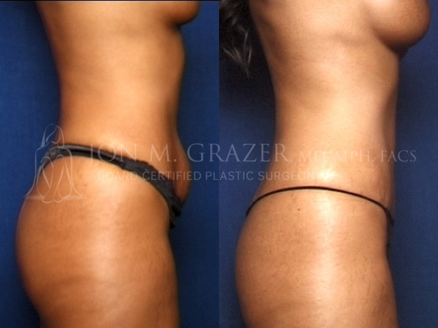 Before and After Image