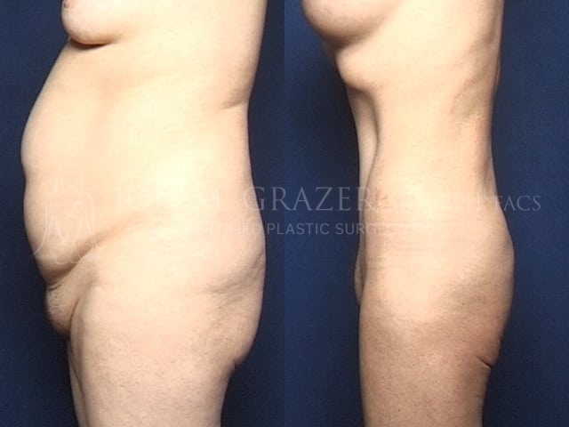 Before and After Image