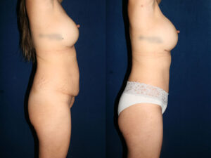 Before and After Image