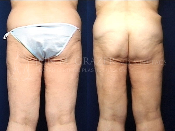 Before and After Image