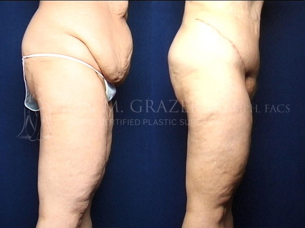 Before and After Image