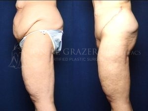 Before and After Image