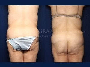 Before and After Image