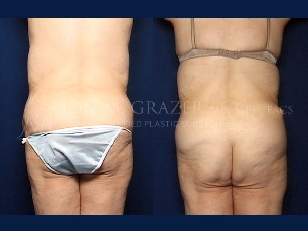 Before and After Image