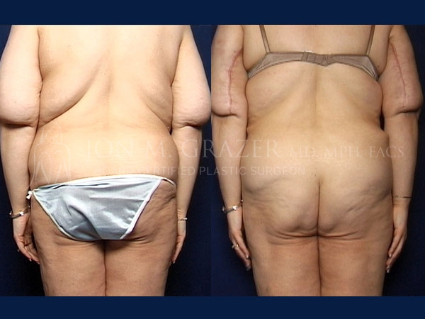 Before and After Image