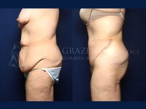 Before and After Image