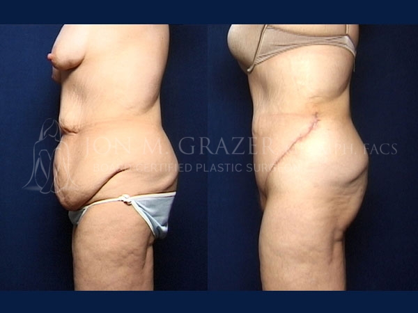 Before and After Image